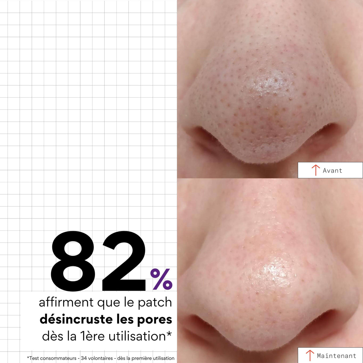 PEEL OUT Patchs Nez Purifiant x5